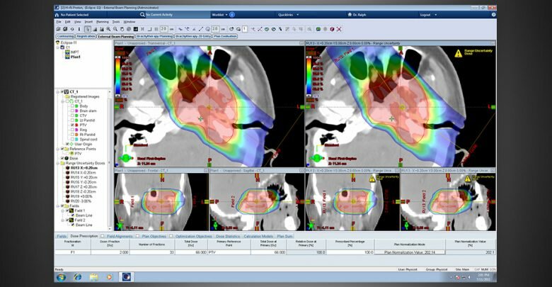 Radiation Therapy Software