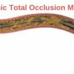 Chronic Total Occlusion Market
